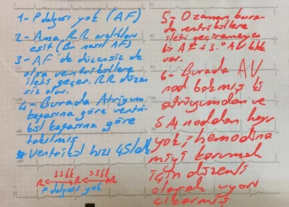 EKG´yi nasıl bilirsiniz?